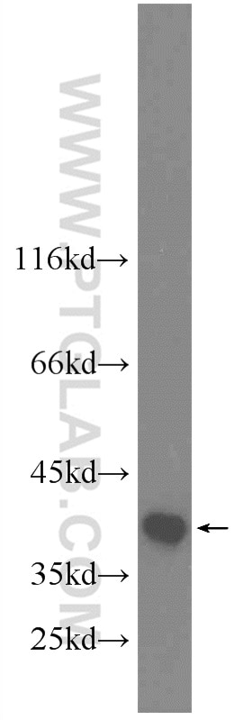 Western Blot (WB) analysis of HEK-293 cells using TIMM50 Polyclonal antibody (22229-1-AP)