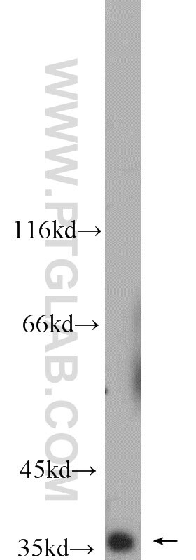 Western Blot (WB) analysis of rat kidney tissue using TIMM50 Polyclonal antibody (22229-1-AP)