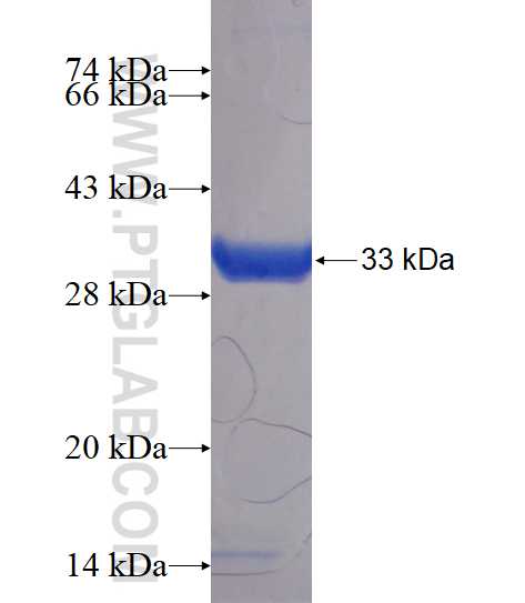 TIMM50 fusion protein Ag17594 SDS-PAGE