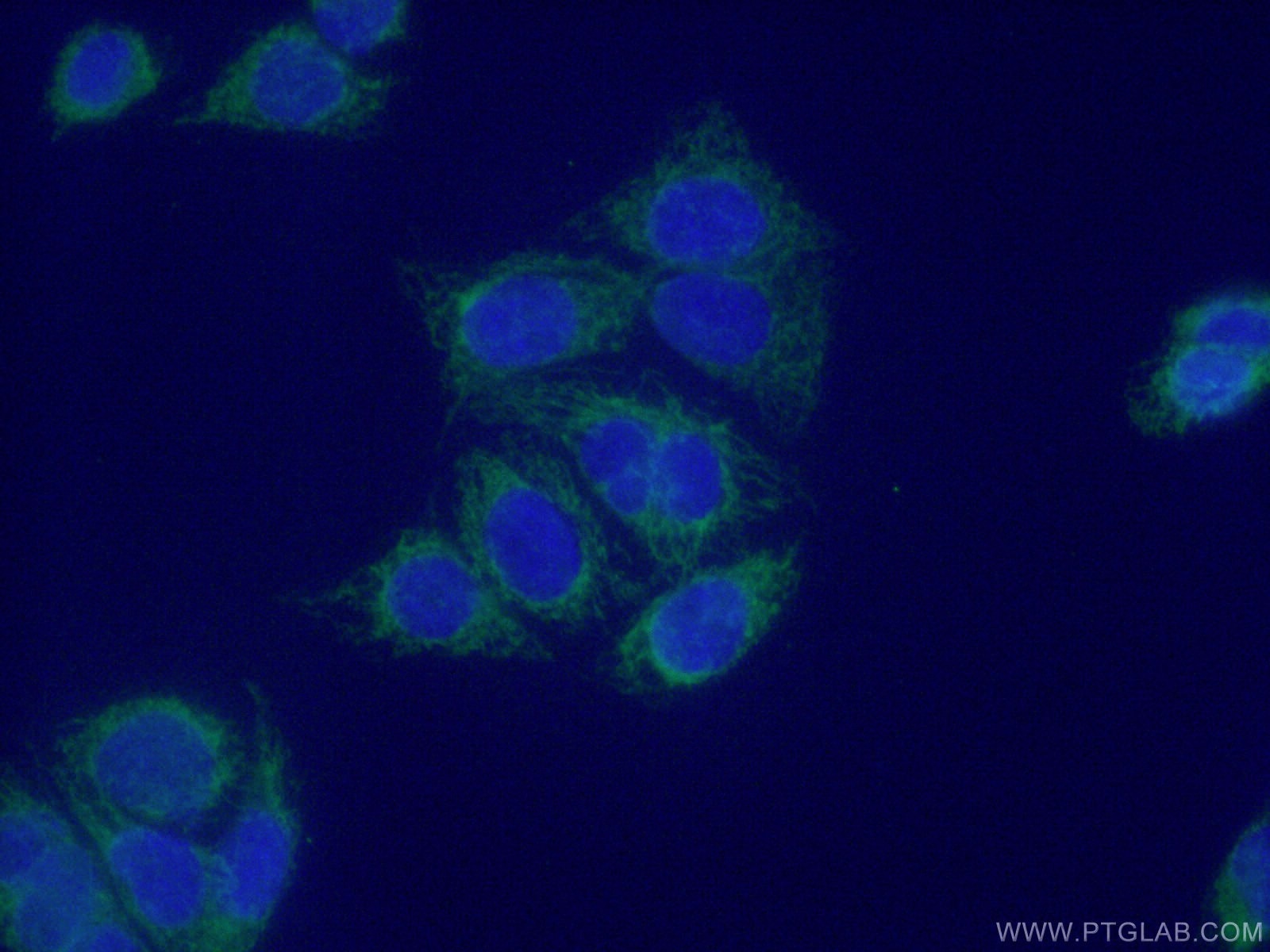 Immunofluorescence (IF) / fluorescent staining of HeLa cells using TIMM8A Polyclonal antibody (11179-1-AP)