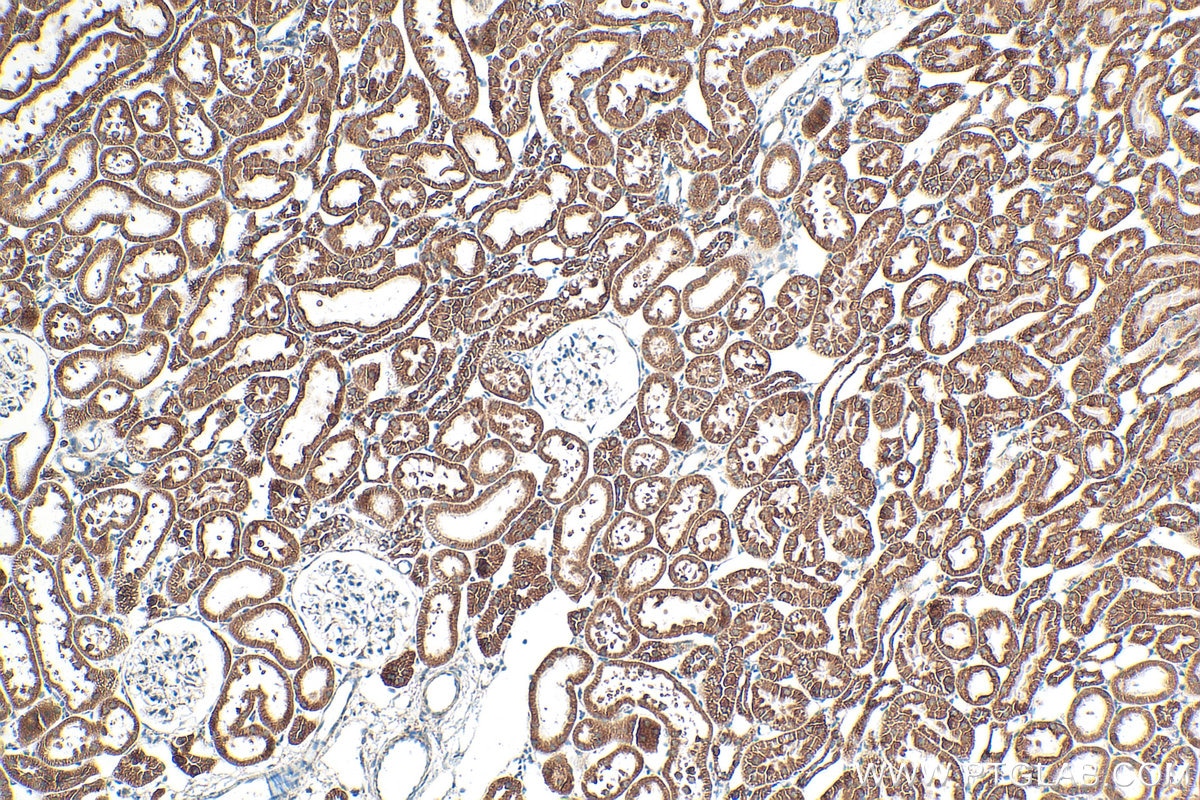 Immunohistochemistry (IHC) staining of rat kidney tissue using TIMM8A Polyclonal antibody (11179-1-AP)