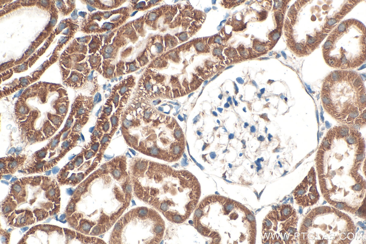 Immunohistochemistry (IHC) staining of rat kidney tissue using TIMM8A Polyclonal antibody (11179-1-AP)