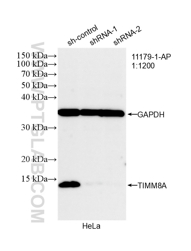Western Blot (WB) analysis of HeLa cells using TIMM8A Polyclonal antibody (11179-1-AP)