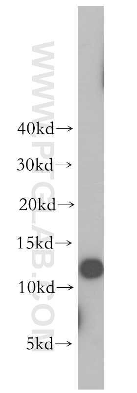 TIMM8A Polyclonal antibody