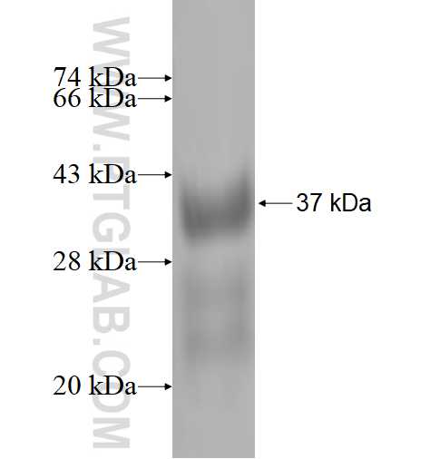 TIMM8A fusion protein Ag1661 SDS-PAGE