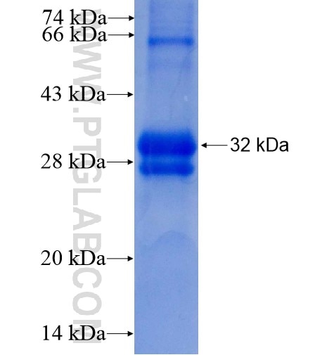 TIMM8B fusion protein Ag6521 SDS-PAGE