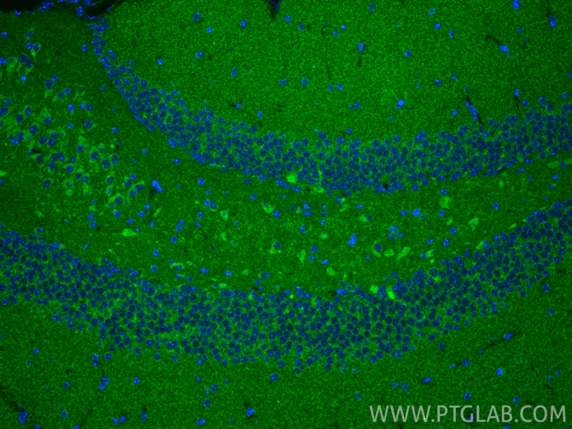 Immunofluorescence (IF) / fluorescent staining of mouse brain tissue using TIMM9 Polyclonal antibody (11479-1-AP)