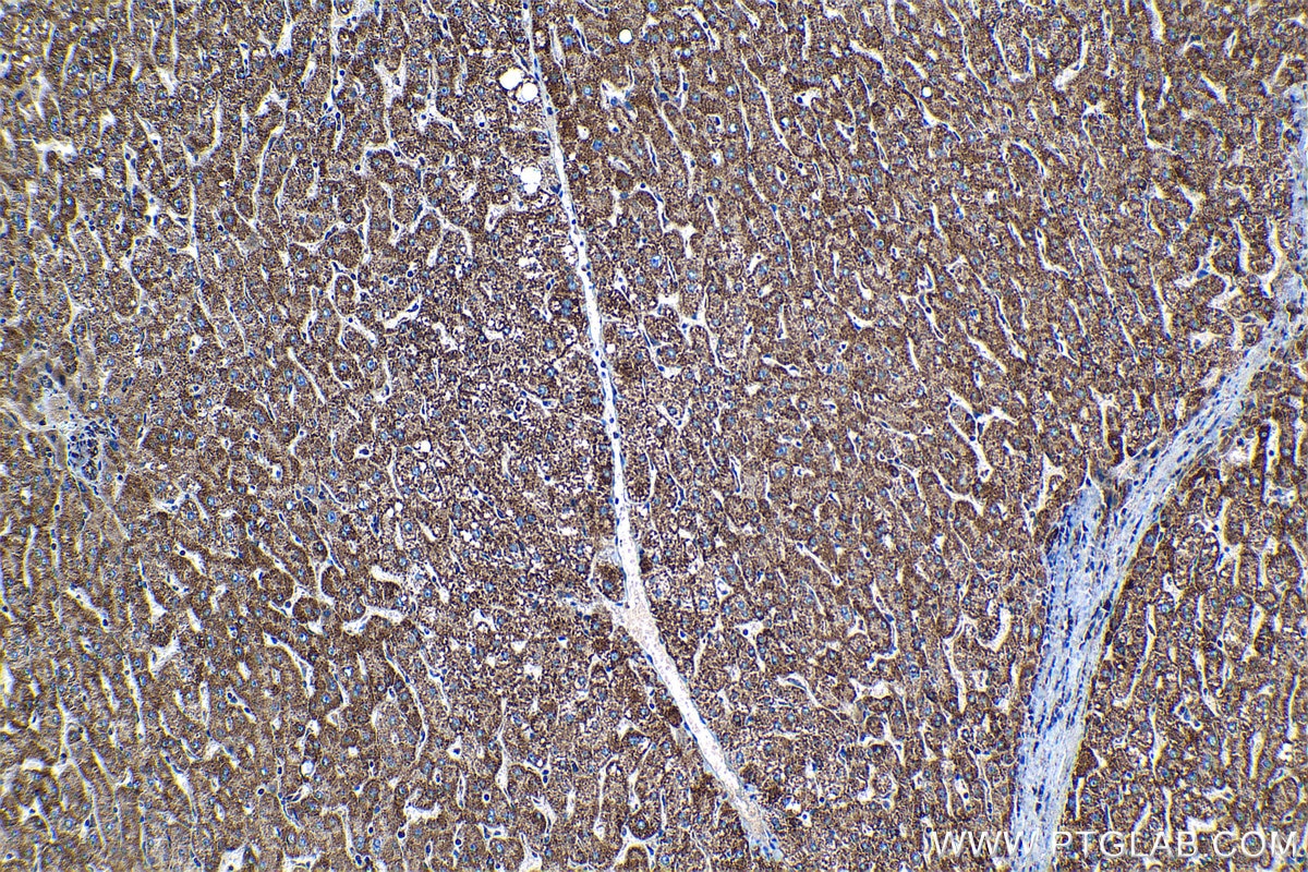IHC staining of human liver using 11479-1-AP