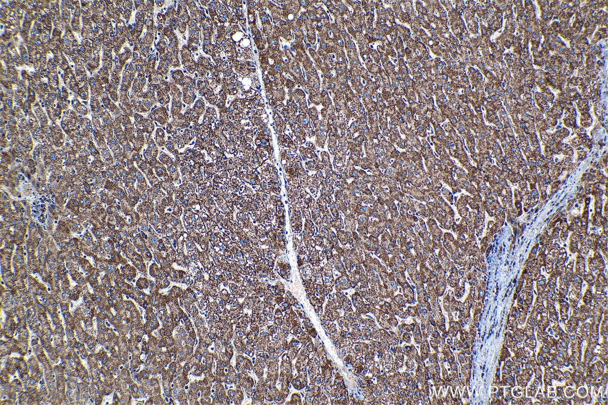 Immunohistochemistry (IHC) staining of human liver tissue using TIMM9 Polyclonal antibody (11479-1-AP)