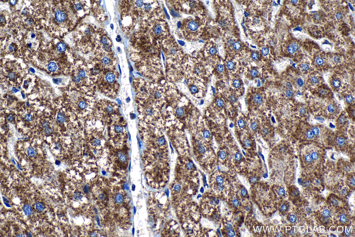 Immunohistochemistry (IHC) staining of human liver tissue using TIMM9 Polyclonal antibody (11479-1-AP)