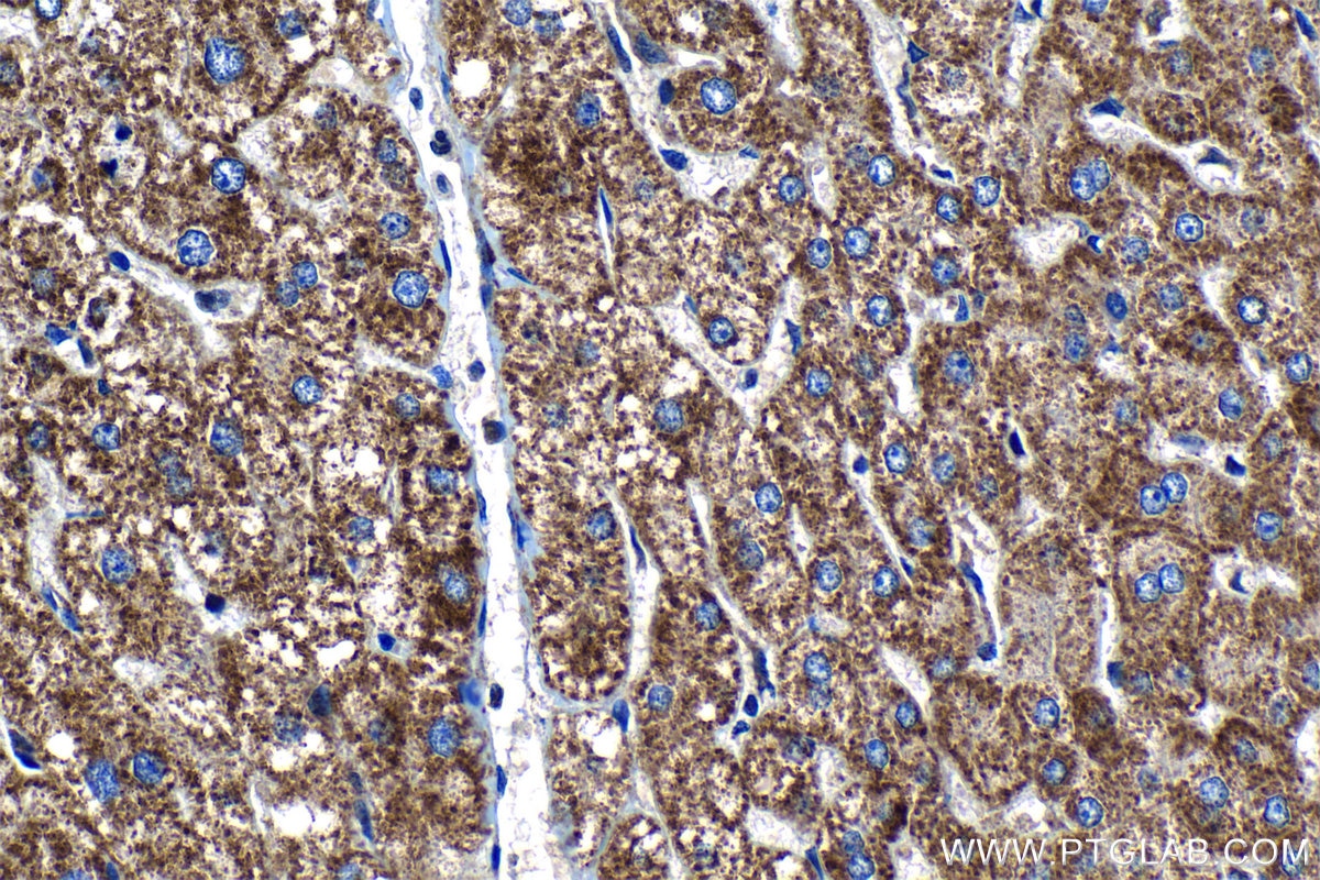 IHC staining of human liver using 11479-1-AP