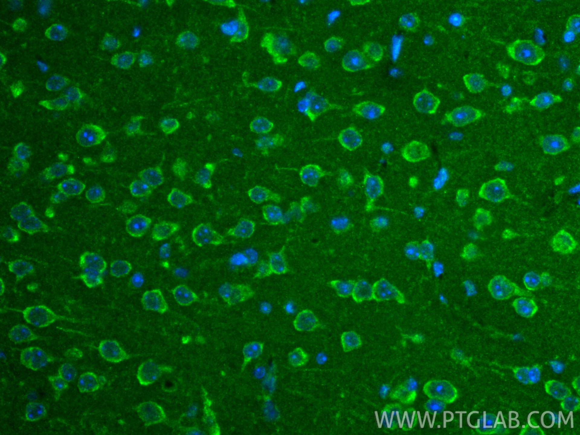 Immunofluorescence (IF) / fluorescent staining of mouse brain tissue using TIMMDC1 Polyclonal antibody (23622-1-AP)