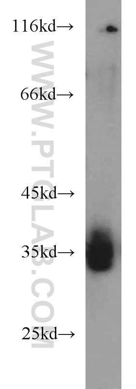 Western Blot (WB) analysis of A375 cells using TIMMDC1 Polyclonal antibody (23622-1-AP)