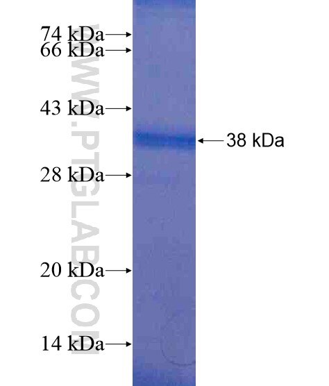 TIMMDC1 fusion protein Ag20017 SDS-PAGE