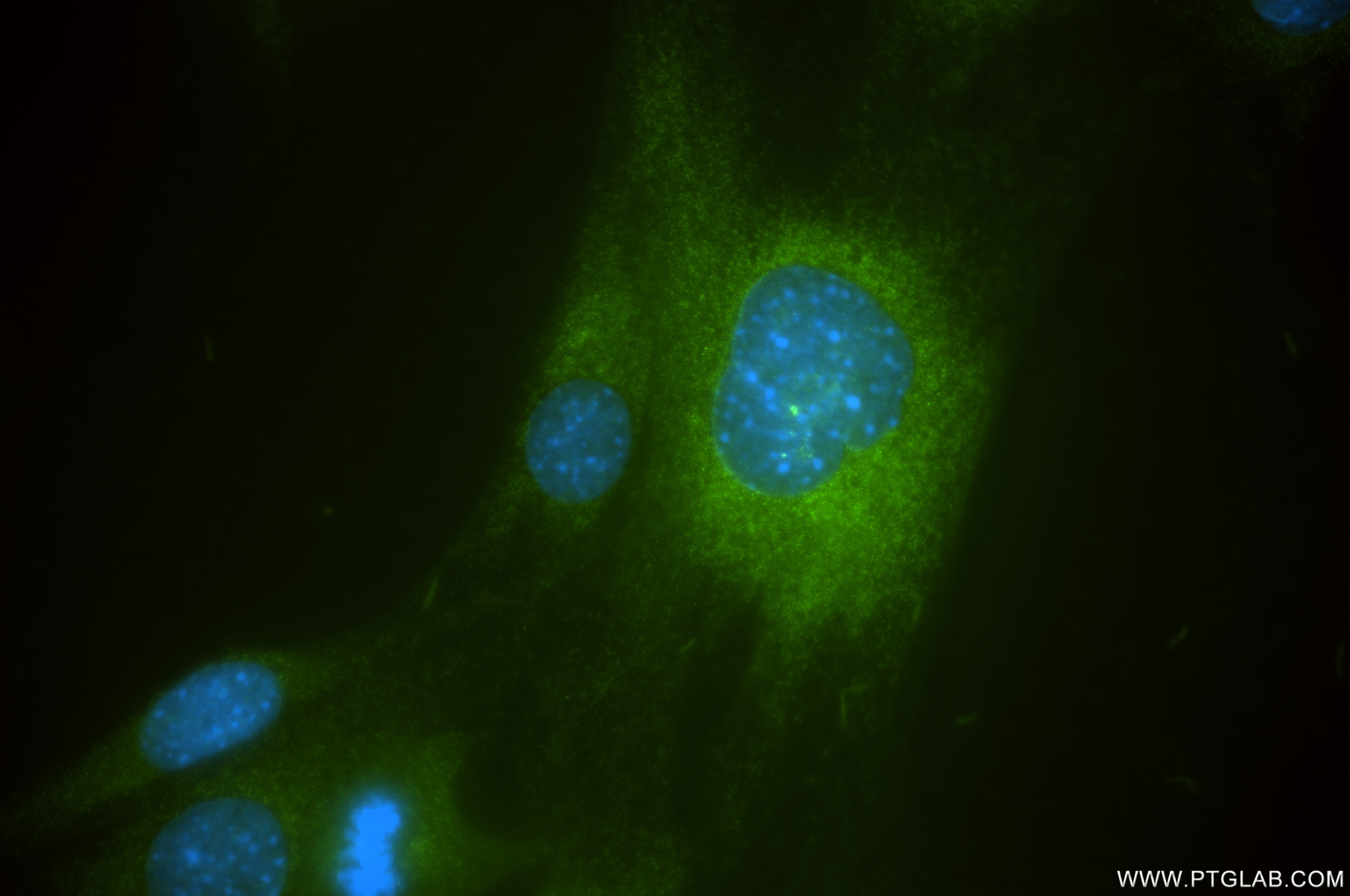 Immunofluorescence (IF) / fluorescent staining of C2C12 cells using TIMP1 Recombinant monoclonal antibody (85959-1-RR)