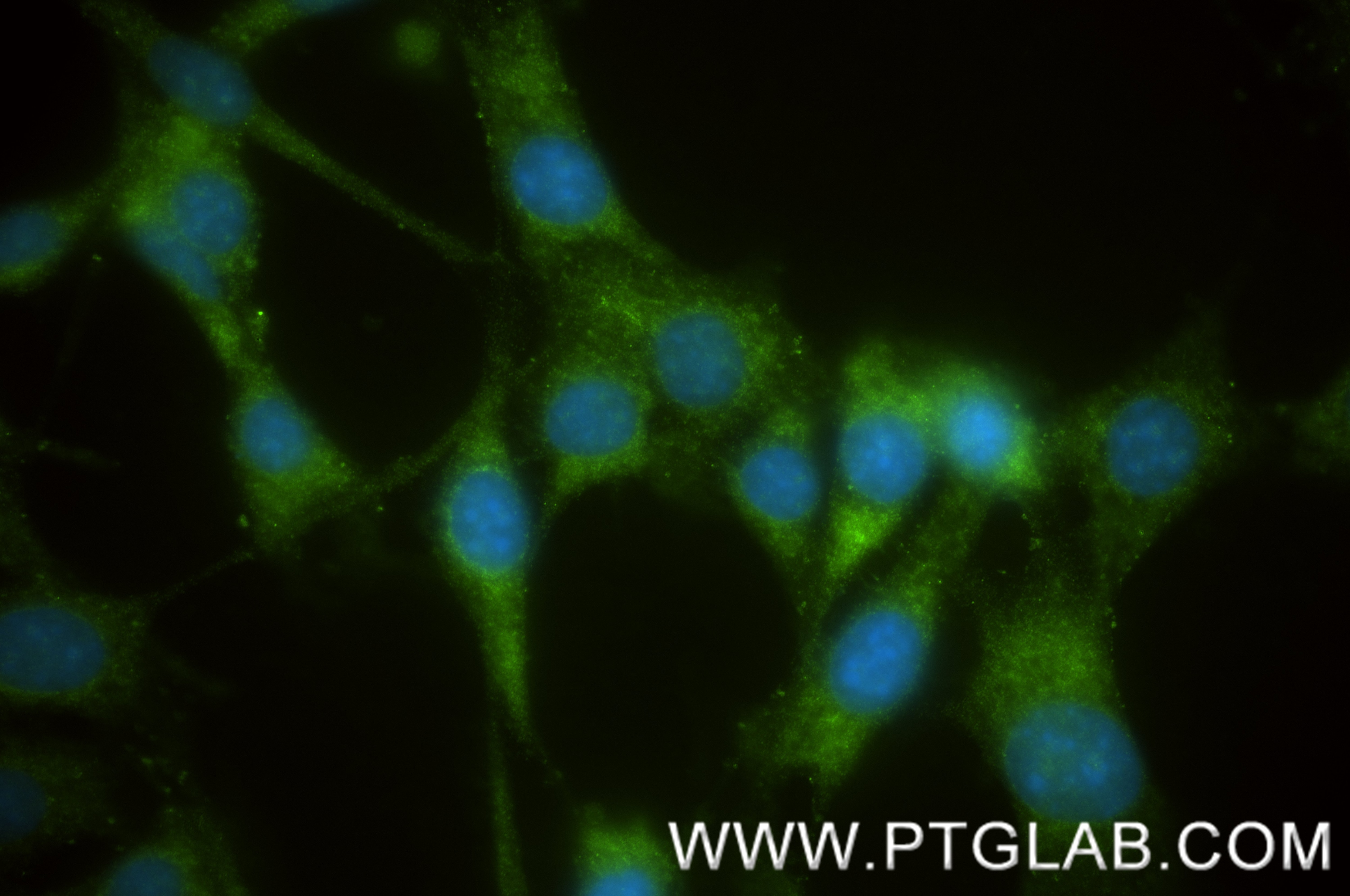 Immunofluorescence (IF) / fluorescent staining of NIH/3T3 cells using TIMP1 Recombinant monoclonal antibody (85959-1-RR)