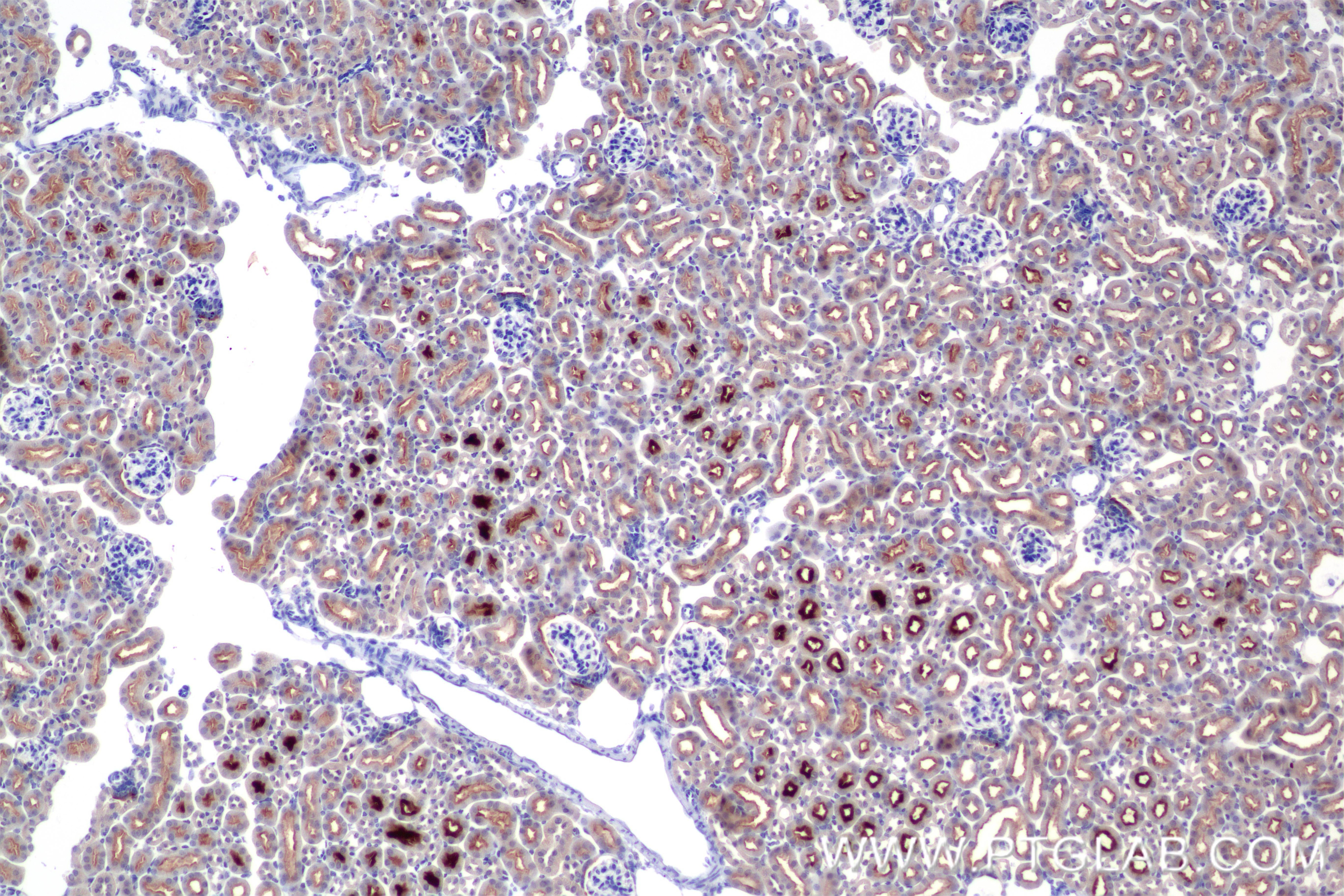 Immunohistochemistry (IHC) staining of mouse kidney tissue using TIMP1 Recombinant antibody (85959-1-RR)