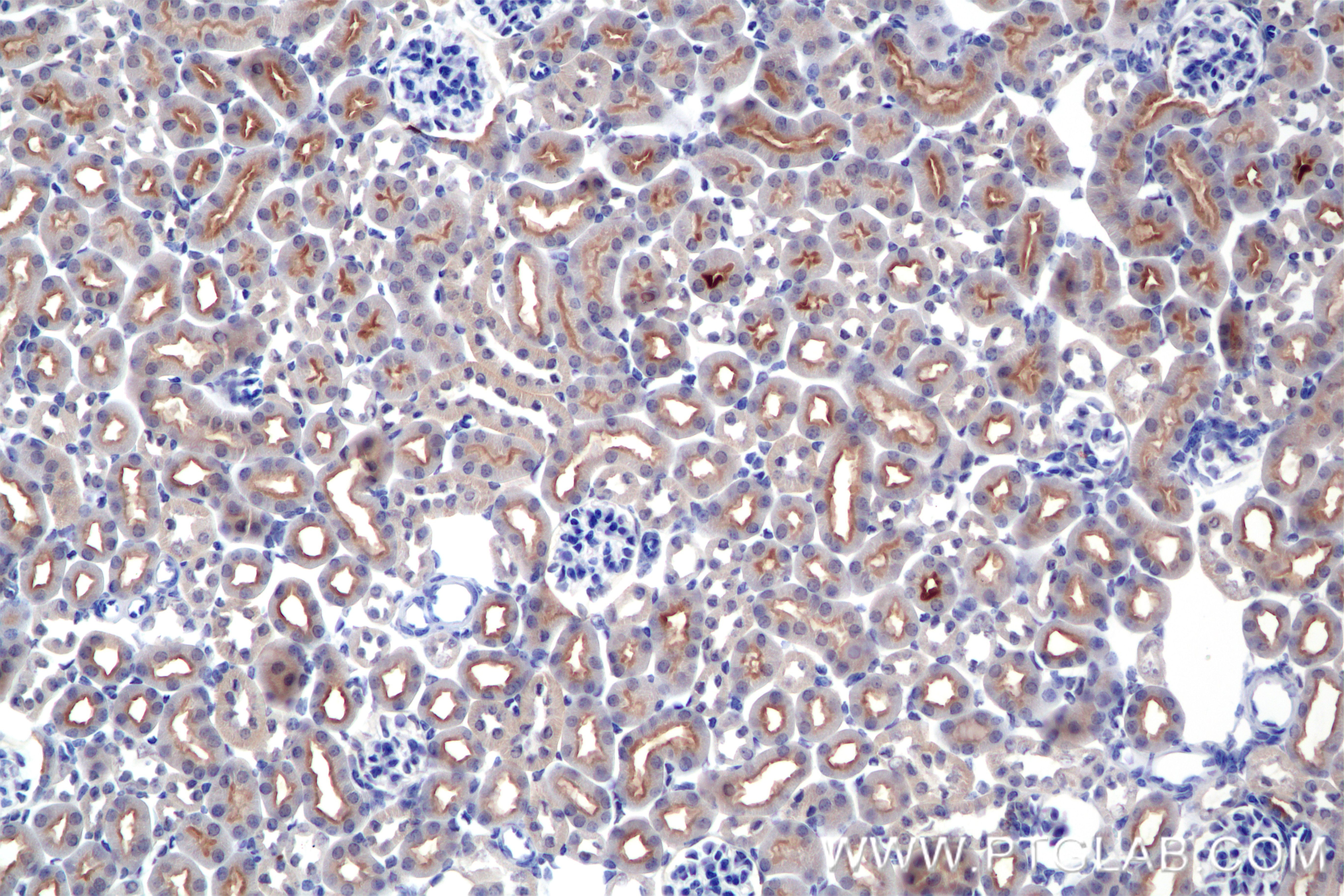 Immunohistochemistry (IHC) staining of mouse kidney tissue using TIMP1 Recombinant antibody (85959-1-RR)