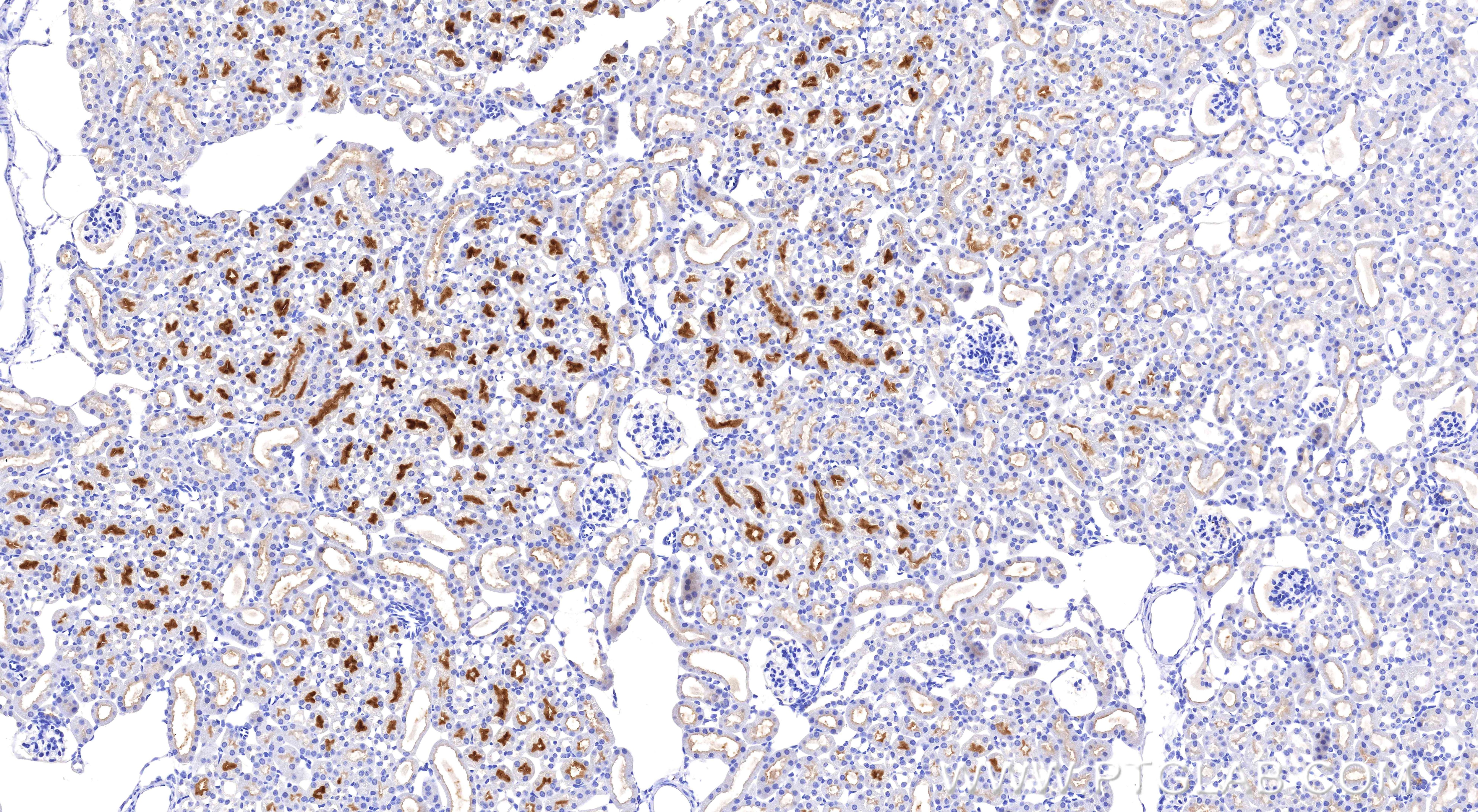 Immunohistochemistry (IHC) staining of mouse kidney tissue using TIMP1 Recombinant monoclonal antibody (85959-1-RR)