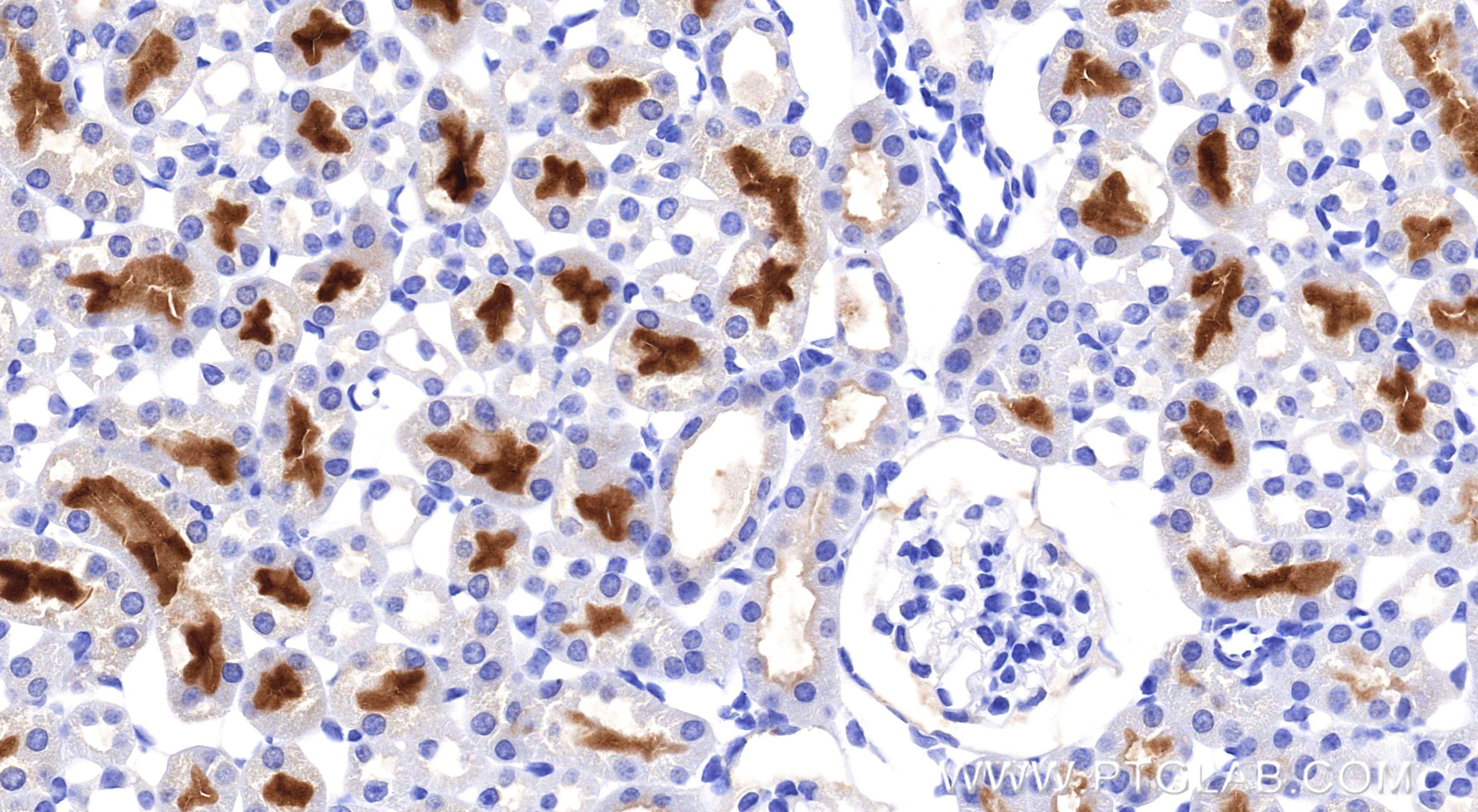 Immunohistochemistry (IHC) staining of mouse kidney tissue using TIMP1 Recombinant monoclonal antibody (85959-1-RR)