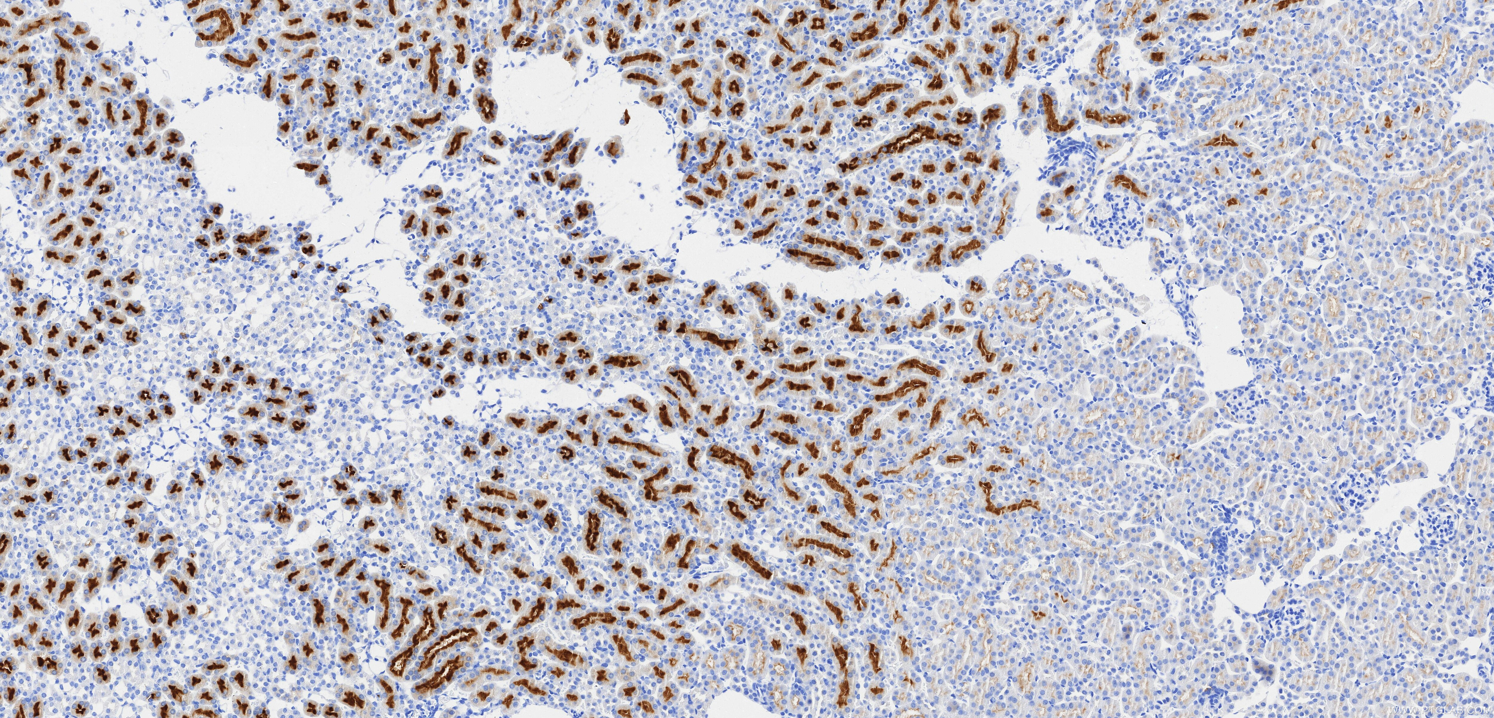 Immunohistochemistry (IHC) staining of mouse kidney tissue using TIMP1 Recombinant monoclonal antibody (85959-1-RR)