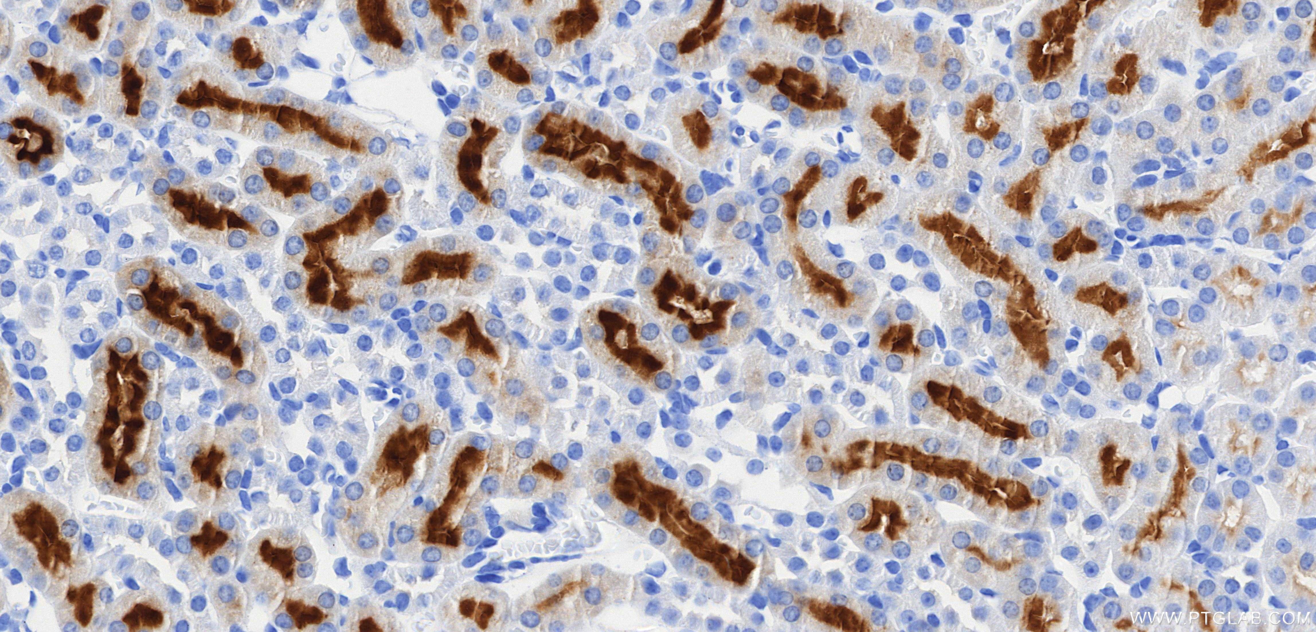 Immunohistochemistry (IHC) staining of mouse kidney tissue using TIMP1 Recombinant monoclonal antibody (85959-1-RR)