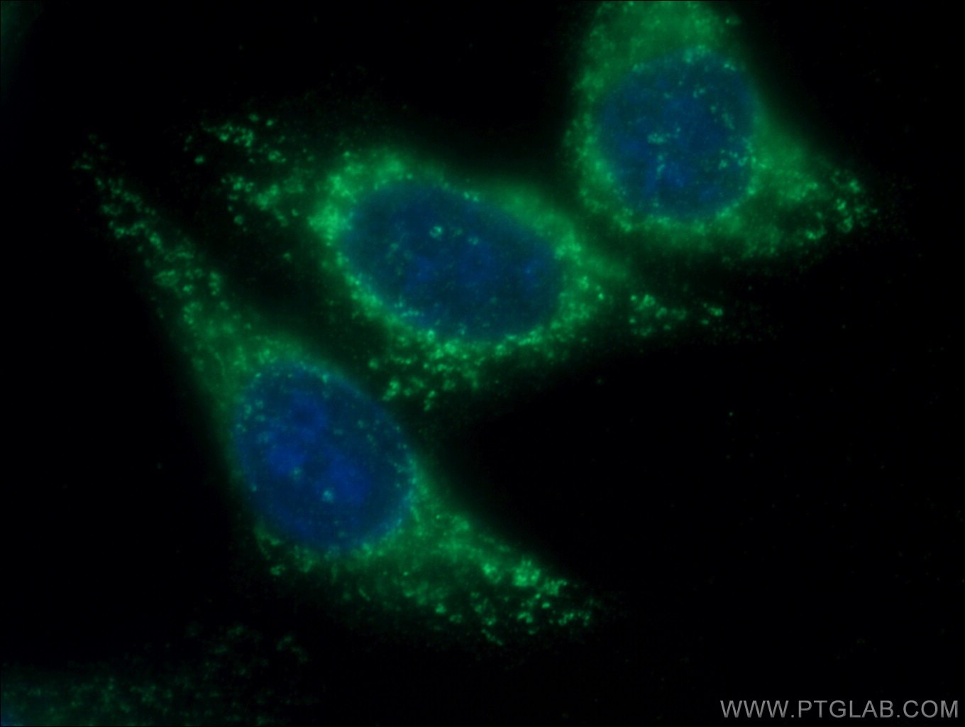 Immunofluorescence (IF) / fluorescent staining of HepG2 cells using TIMP1 Polyclonal antibody (10753-1-AP)