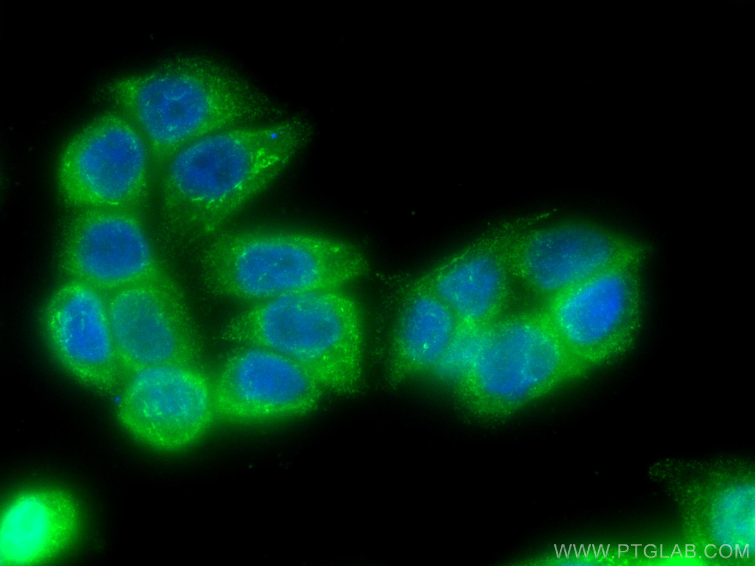 Immunofluorescence (IF) / fluorescent staining of HT-29 cells using TIMP1 Polyclonal antibody (16644-1-AP)