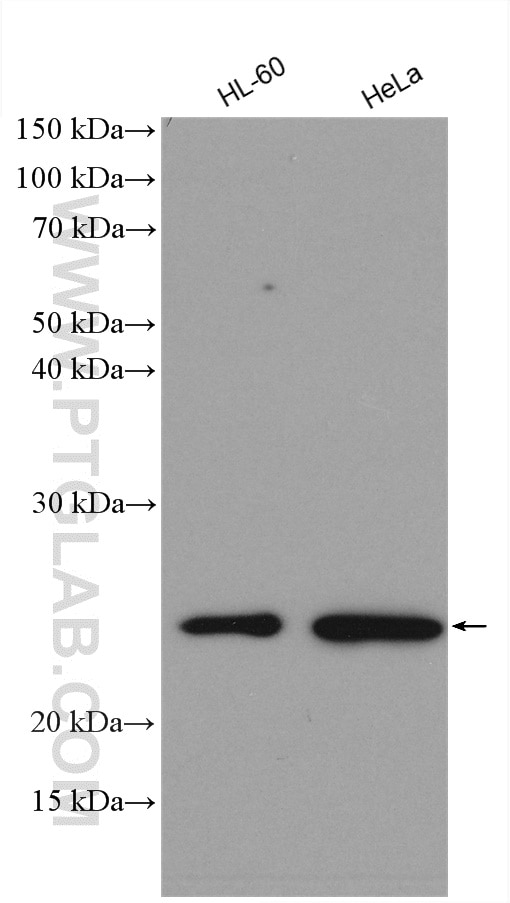 Western Blot (WB) analysis of various lysates using TIMP1 Polyclonal antibody (16644-1-AP)