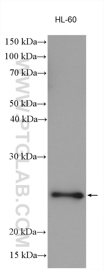 WB analysis using 16644-1-AP