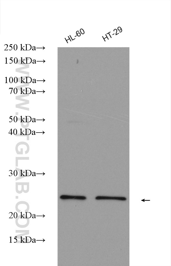Western Blot (WB) analysis of various lysates using TIMP1 Polyclonal antibody (16644-1-AP)