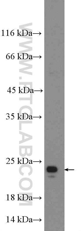 TIMP1 Polyclonal antibody