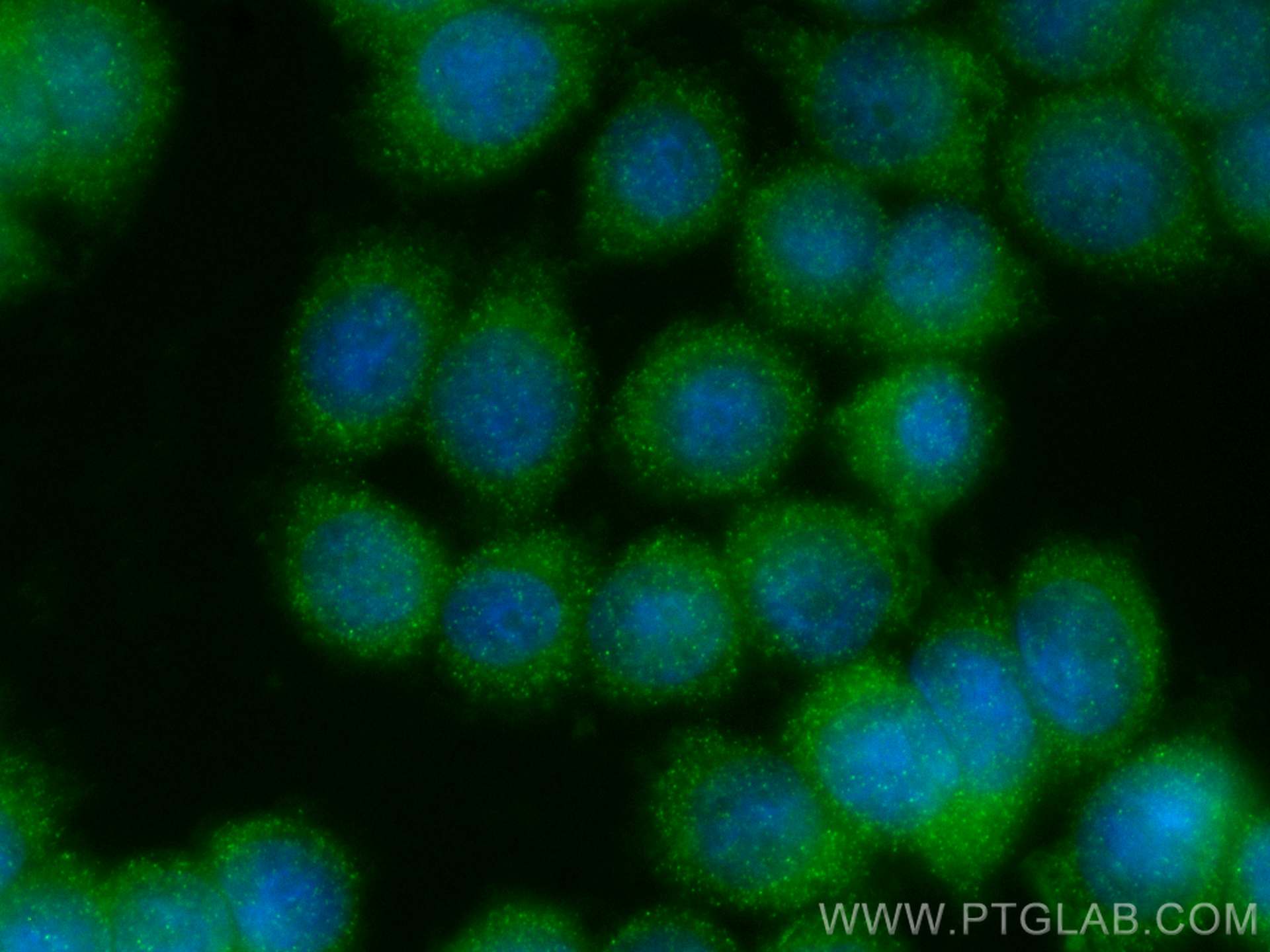 Immunofluorescence (IF) / fluorescent staining of HT-29 cells using TIMP1 Polyclonal antibody (26847-1-AP)