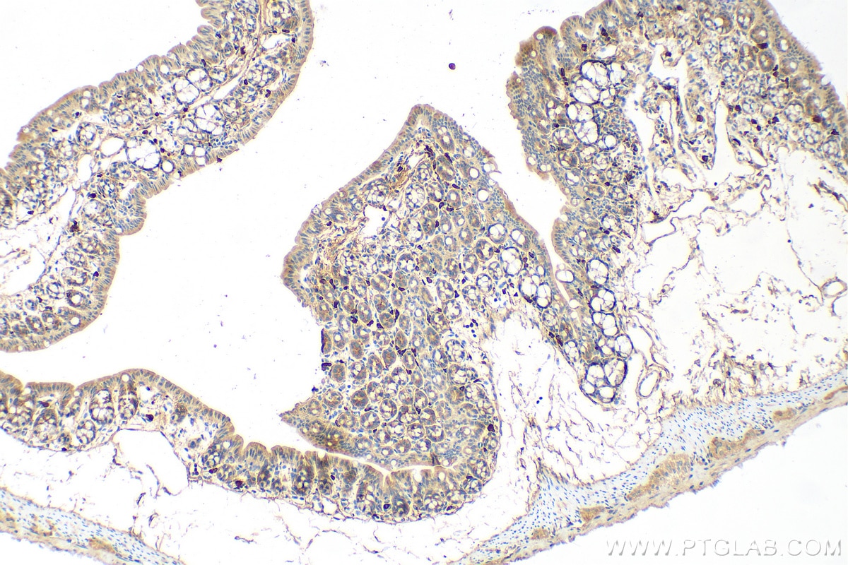 Immunohistochemistry (IHC) staining of mouse colon tissue using TIMP1 Polyclonal antibody (26847-1-AP)