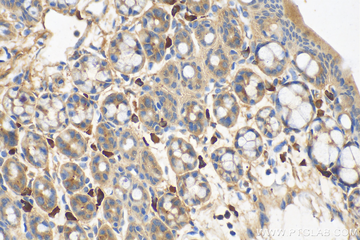 Immunohistochemistry (IHC) staining of mouse colon tissue using TIMP1 Polyclonal antibody (26847-1-AP)