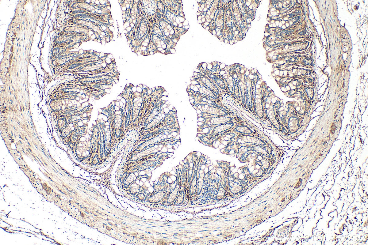 Immunohistochemistry (IHC) staining of mouse colon tissue using TIMP1 Polyclonal antibody (26847-1-AP)