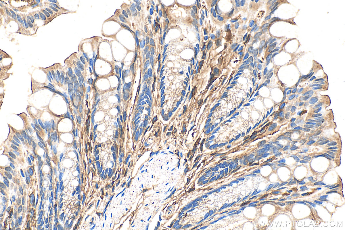 Immunohistochemistry (IHC) staining of mouse colon tissue using TIMP1 Polyclonal antibody (26847-1-AP)