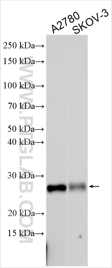 Western Blot (WB) analysis of various lysates using TIMP1 Polyclonal antibody (26847-1-AP)