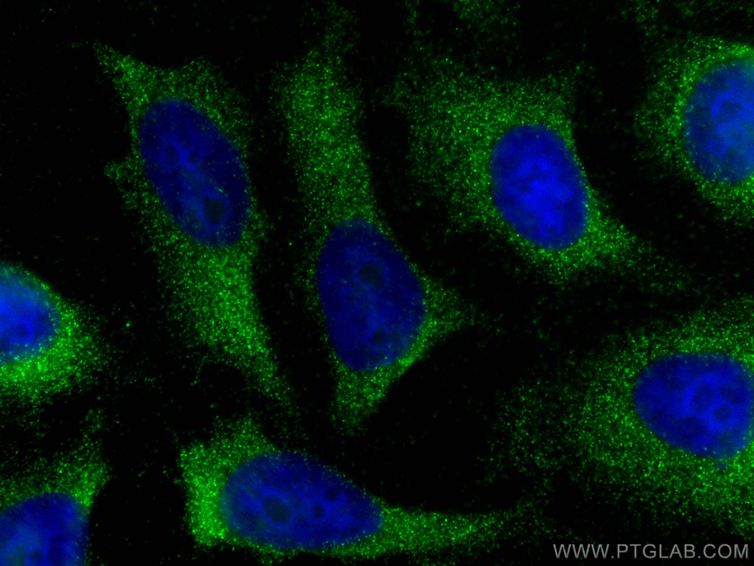 Immunofluorescence (IF) / fluorescent staining of HeLa cells using TIMP1 Polyclonal antibody (30755-1-AP)