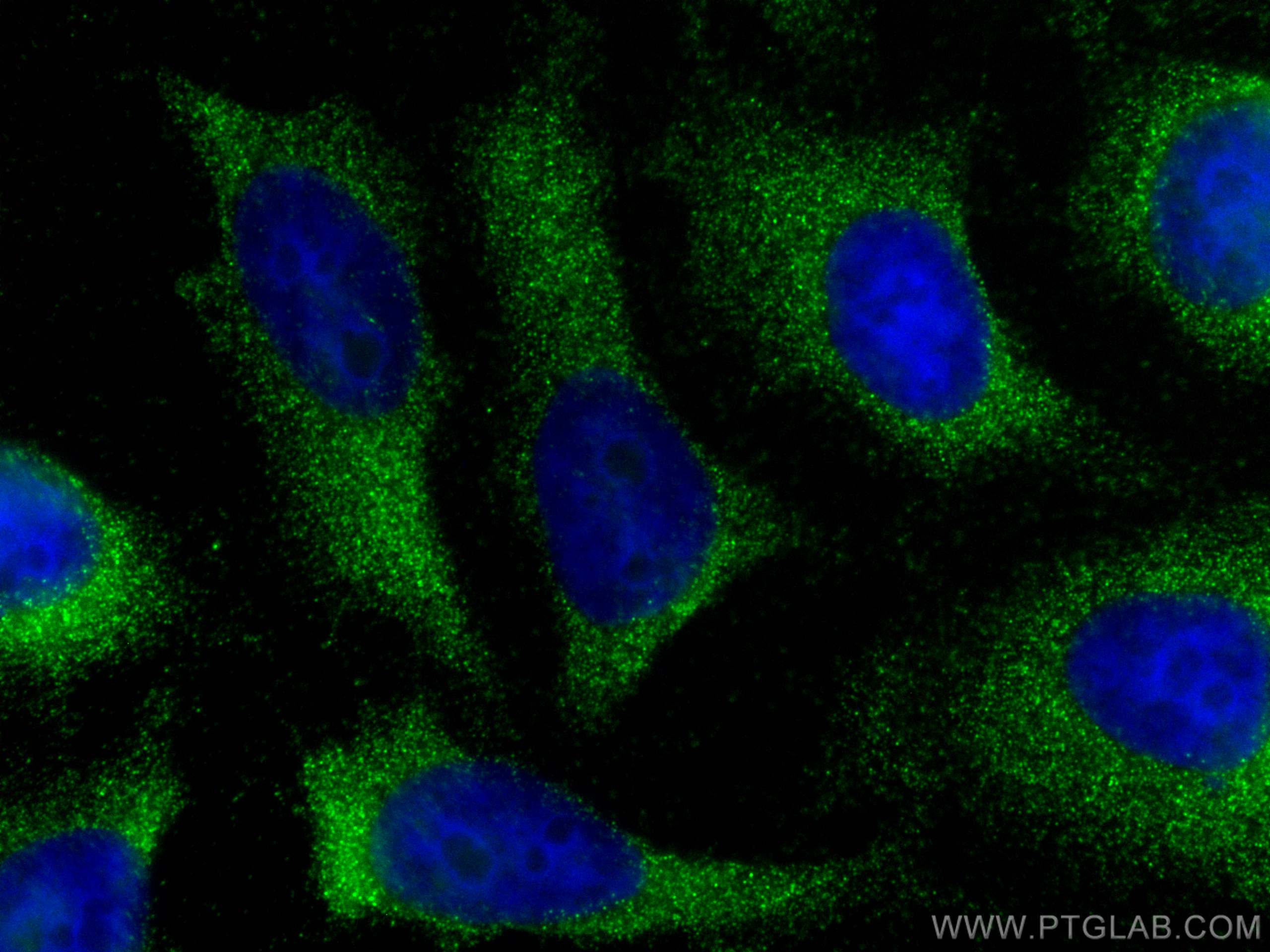 IF Staining of HeLa using 30755-1-AP