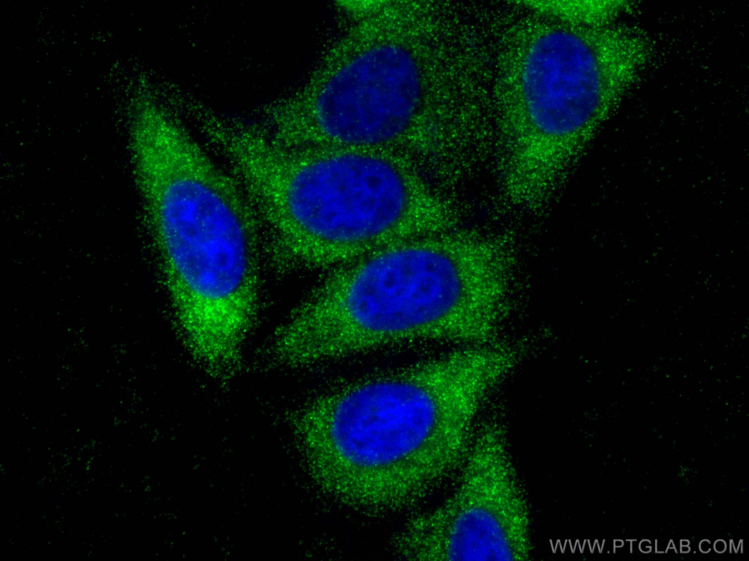 Immunofluorescence (IF) / fluorescent staining of HepG2 cells using TIMP1 Polyclonal antibody (30755-1-AP)