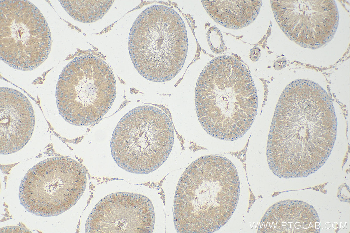 Immunohistochemistry (IHC) staining of rat testis tissue using TIMP1 Polyclonal antibody (30755-1-AP)