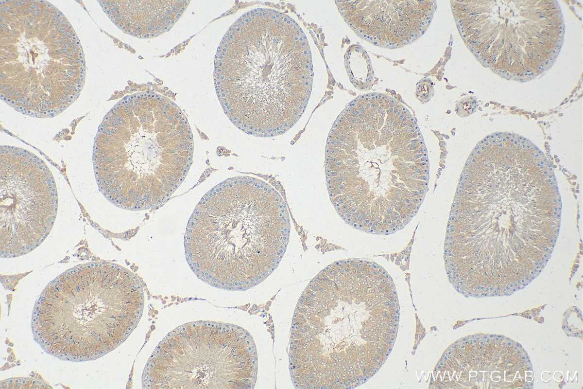 IHC staining of rat testis using 30755-1-AP