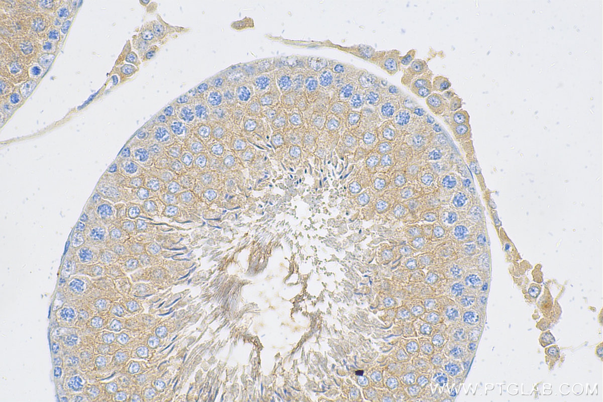 Immunohistochemistry (IHC) staining of rat testis tissue using TIMP1 Polyclonal antibody (30755-1-AP)