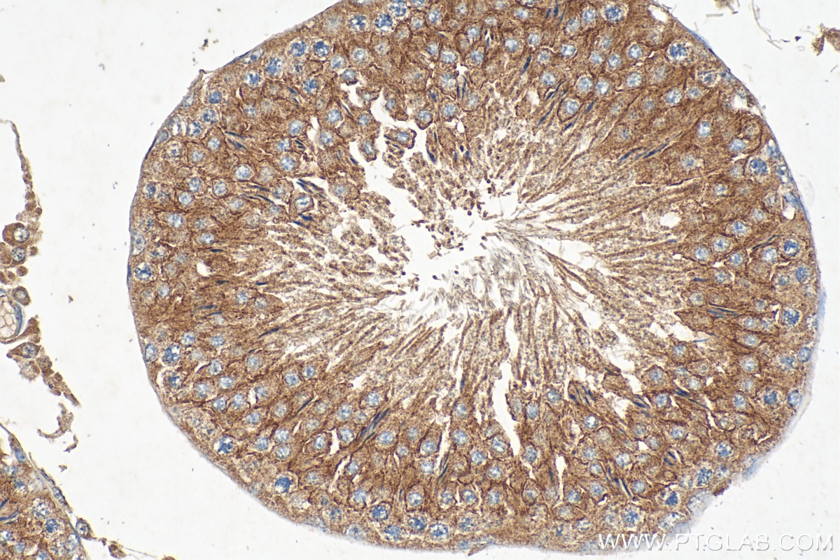 Immunohistochemistry (IHC) staining of rat testis tissue using TIMP1 Polyclonal antibody (30755-1-AP)