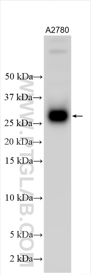 Western Blot (WB) analysis of various lysates using TIMP1 Polyclonal antibody (30755-1-AP)