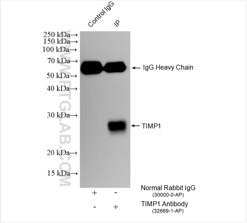 Immunoprecipitation (IP) experiment of rat lung tissue using TIMP1 Polyclonal antibody (32669-1-AP)
