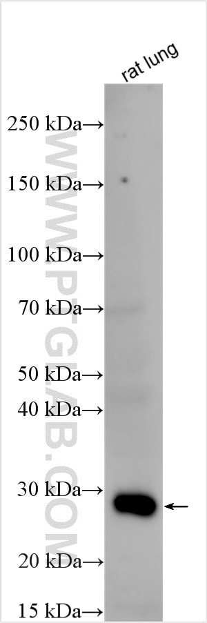 Western Blot (WB) analysis of various lysates using TIMP1 Polyclonal antibody (32669-1-AP)