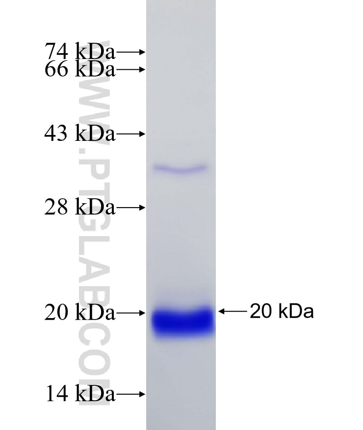 TIMP1 fusion protein Ag22750 SDS-PAGE