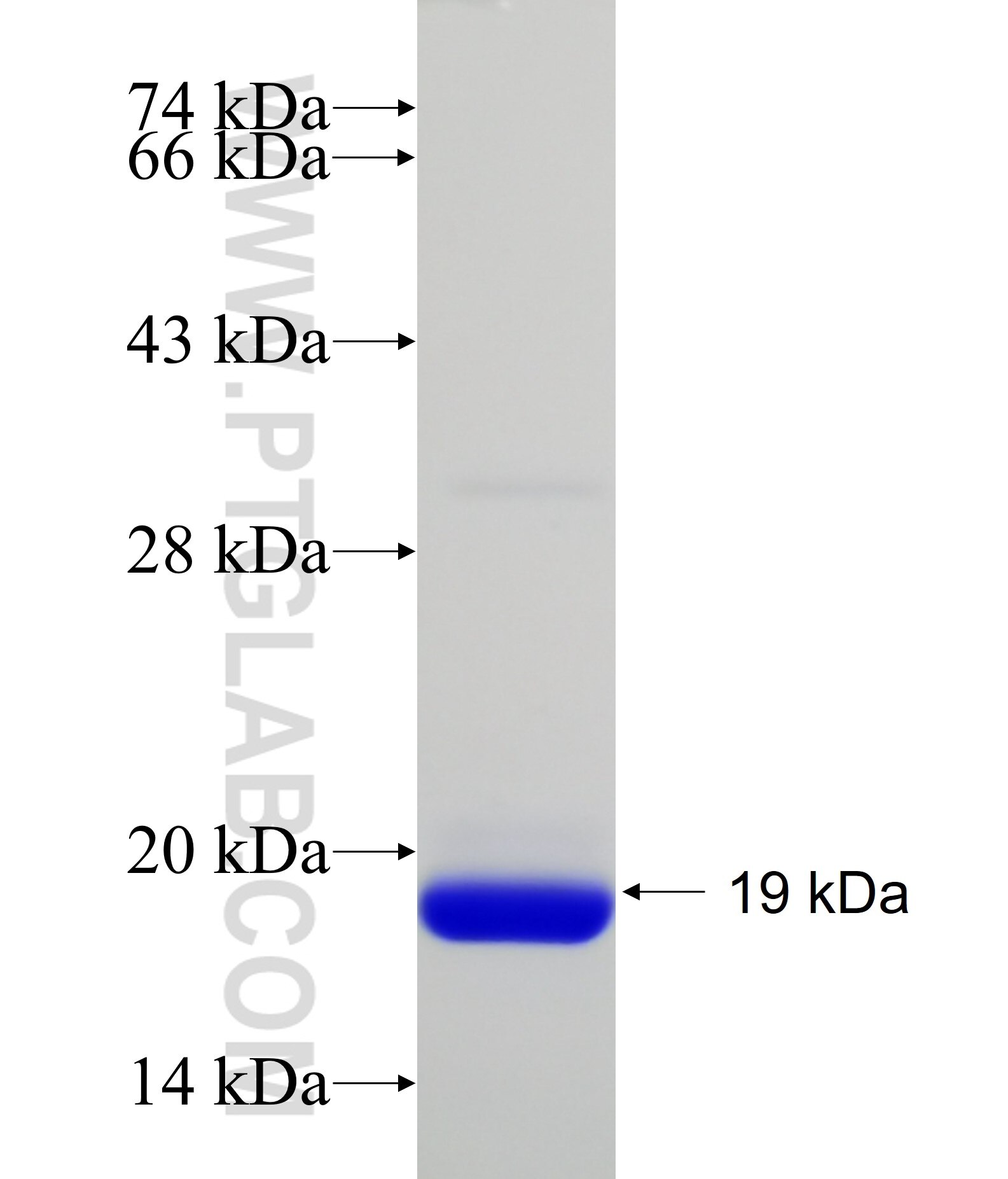 TIMP1 fusion protein Ag22750 SDS-PAGE